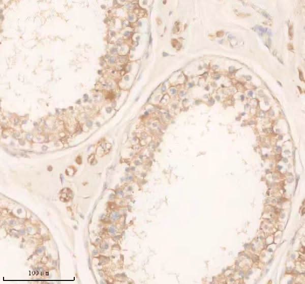 Anti-SLC22A14 Antibody Boster Bio