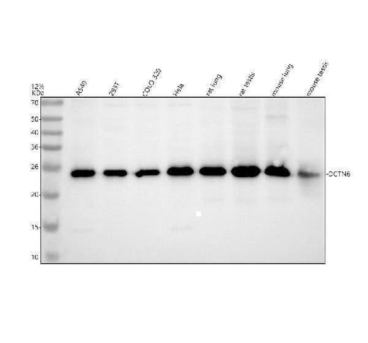 Anti-DCTN6 Antibody Picoband® Boster Bio