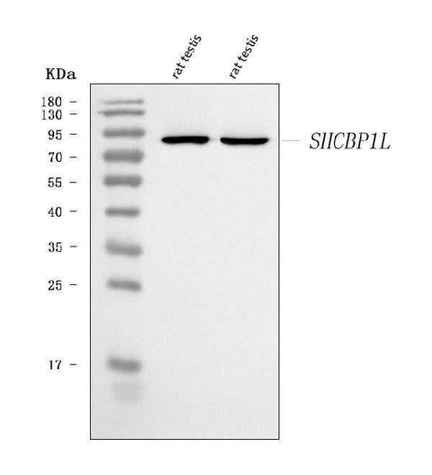 Anti-SHCBP1L Antibody Picoband® Boster Bio