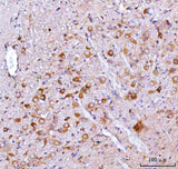 Anti-Nms Antibody Boster Bio