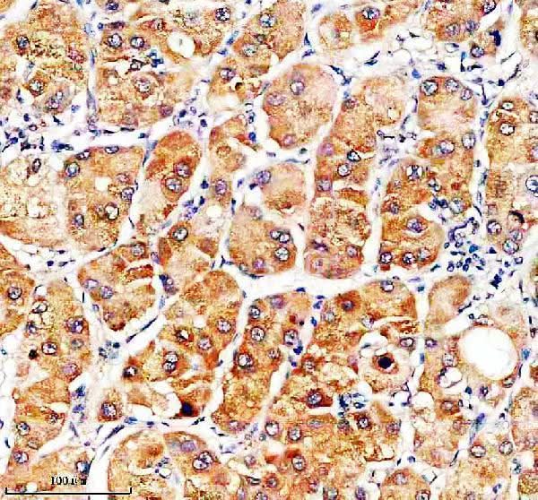 Anti-SLC46A3 Antibody Boster Bio