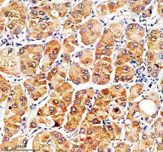 Anti-SLC46A3 Antibody Boster Bio