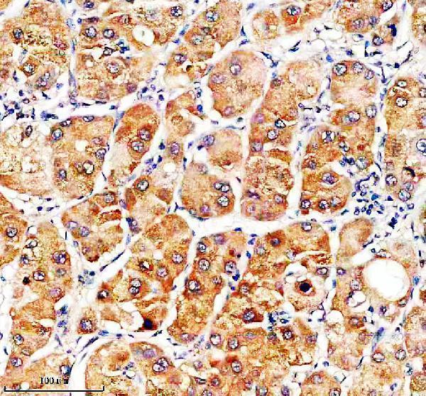 Anti-SLC46A3 Antibody Boster Bio
