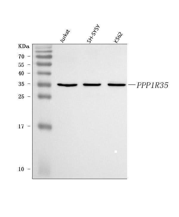 Anti-C7orf47/PPP1R35 Antibody Picoband® Boster Bio