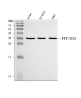 Anti-C7orf47/PPP1R35 Antibody Picoband® Boster Bio