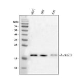 Anti-LAGE3 Antibody Picoband® Boster Bio