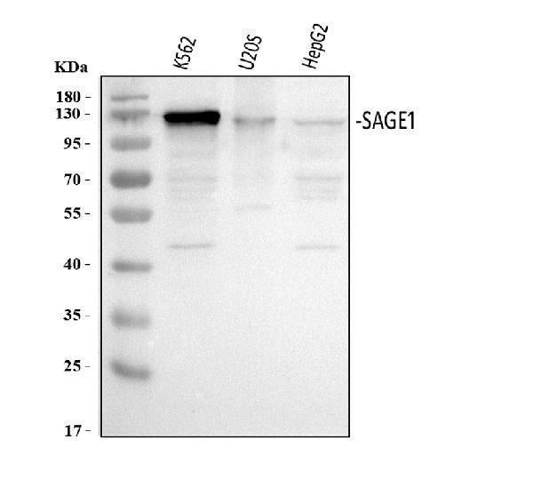 Anti-SAGE1 Antibody Picoband® Boster Bio