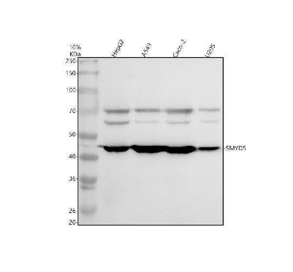 Anti-SMYD5 Antibody Picoband® Boster Bio
