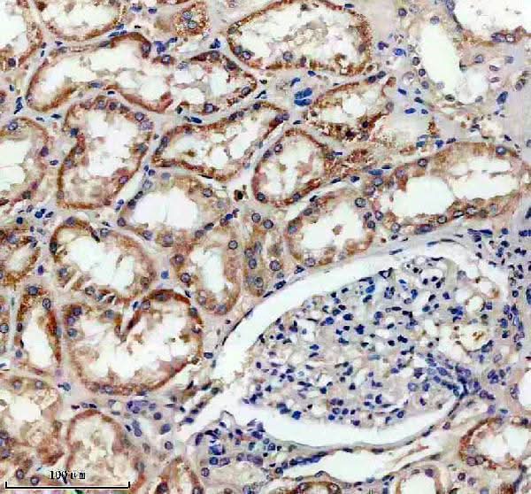 Anti-SLC16A13 Antibody Boster Bio