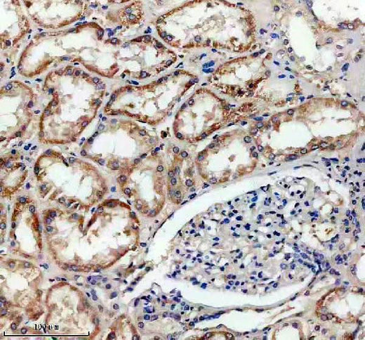 Anti-SLC16A13 Antibody Boster Bio