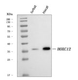 Anti-HOXC12 Antibody Picoband® Boster Bio