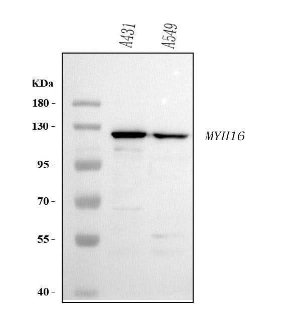 Anti-MYH16 Antibody Picoband® Boster Bio