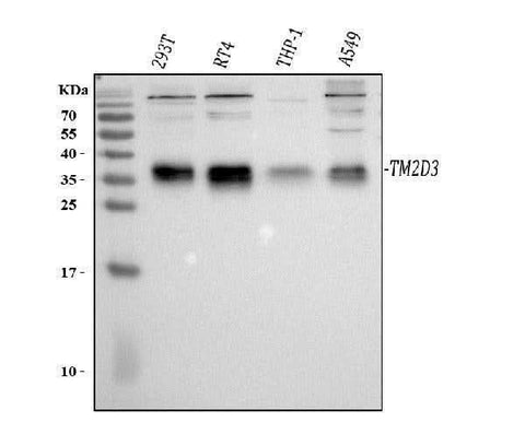 Anti-TM2D3 Antibody Picoband® Boster Bio