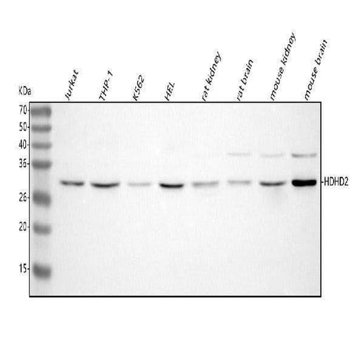 Anti-HDHD2 Antibody Picoband® Boster Bio