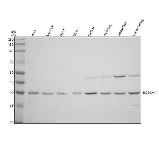 Anti-SLC25A44 Antibody Picoband® Boster Bio