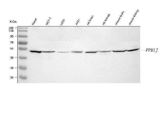 Anti-PPM1J Antibody Picoband® Boster Bio
