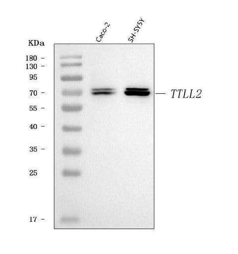 Anti-TTLL2 Antibody Picoband® Boster Bio