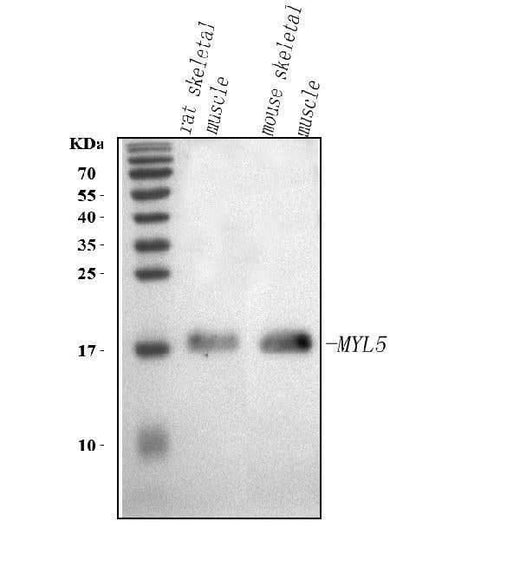 Anti-MYL5 Antibody Picoband® Boster Bio