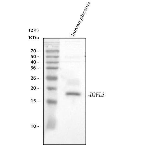 Anti-IGFL3 Antibody Picoband® Boster Bio