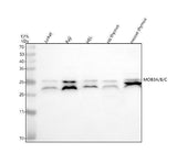 Anti-MOB3A/B/C Antibody Picoband® Boster Bio