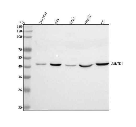 Anti-LMNTD1 Antibody Picoband® Boster Bio