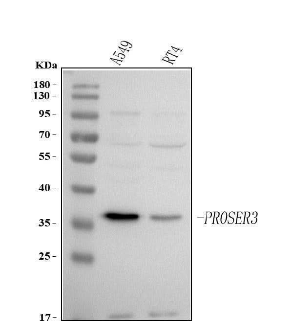 Anti-PROSER3 Antibody Picoband® Boster Bio