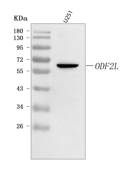 Anti-ODF2L Antibody Picoband® Boster Bio