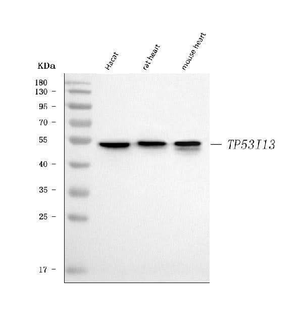 Anti-TP53I13 Antibody Picoband® Boster Bio