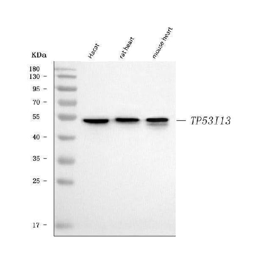 Anti-TP53I13 Antibody Picoband® Boster Bio