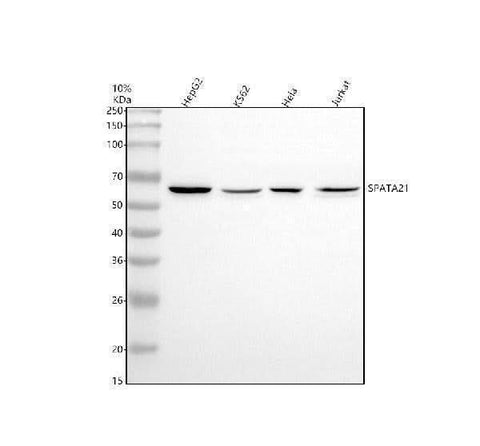Anti-SPATA21 Antibody Picoband® Boster Bio