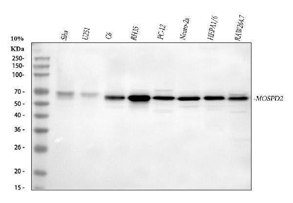 Anti-MOSPD2 Antibody Picoband® Boster Bio
