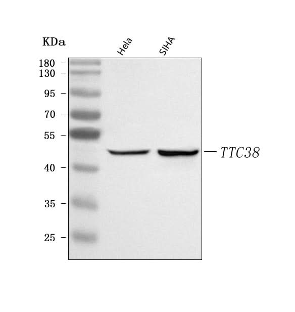 Anti-TTC38 Antibody Picoband® Boster Bio