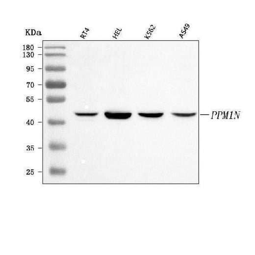 Anti-PPM1N Antibody Picoband® Boster Bio