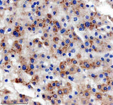 Anti-SLC22A25 Antibody Boster Bio