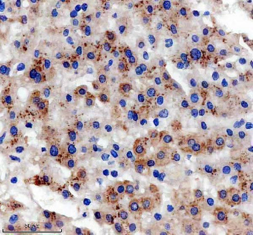 Anti-SLC22A25 Antibody Boster Bio