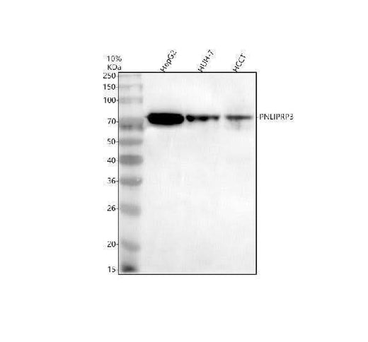 Anti-PNLIPRP3 Antibody Picoband® Boster Bio