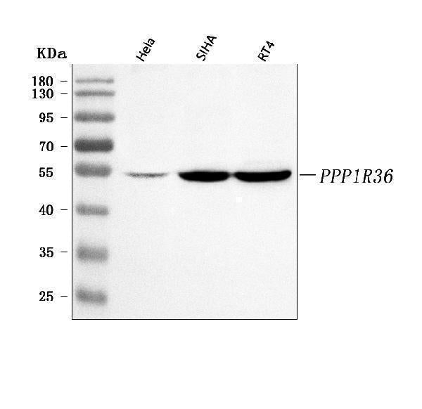 Anti-PPP1R36 Antibody Picoband® Boster Bio