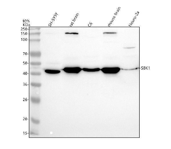 Anti-SBK1 Antibody Picoband® Boster Bio