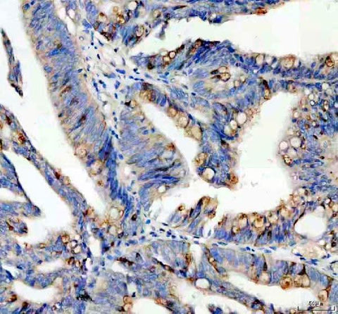 Anti-SPINK4 Antibody Boster Bio