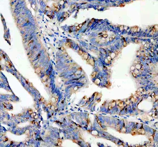 Anti-SPINK4 Antibody Boster Bio