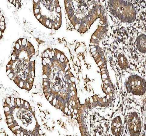 Anti-SMIM8 Antibody Boster Bio