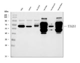 Anti-TIGD1 Antibody Picoband® Boster Bio