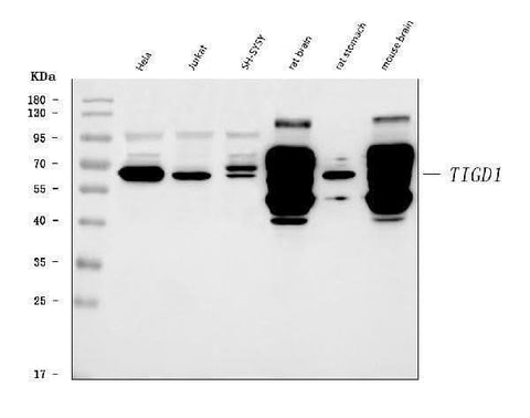 Anti-TIGD1 Antibody Picoband® Boster Bio
