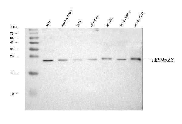 Anti-TMEM52B Antibody Picoband® Boster Bio