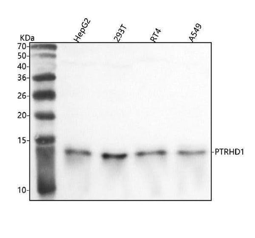 Anti-PTRHD1 Antibody Picoband® Boster Bio