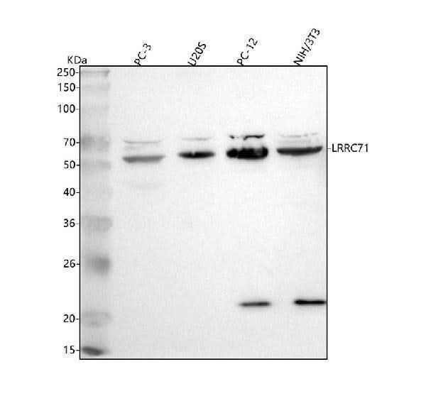 Anti-LRRC71 Antibody Picoband® Boster Bio