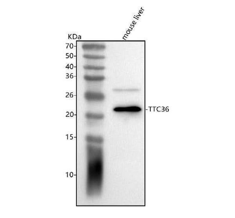 Anti-TTC36 Antibody Picoband® Boster Bio