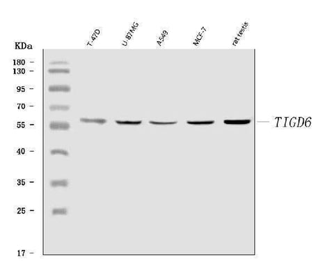 Anti-TIGD6 Antibody Picoband® Boster Bio