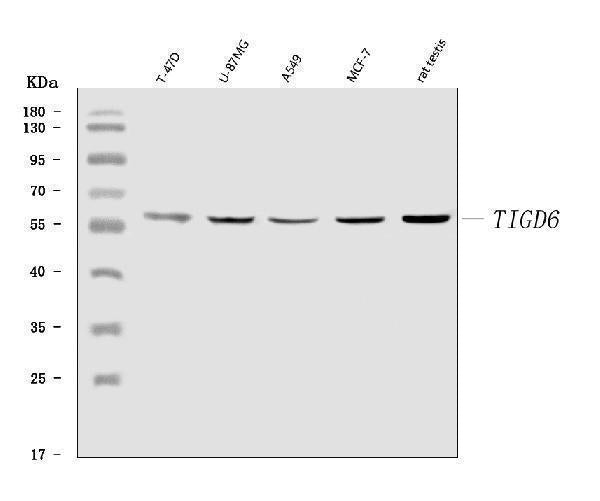 Anti-TIGD6 Antibody Picoband® Boster Bio
