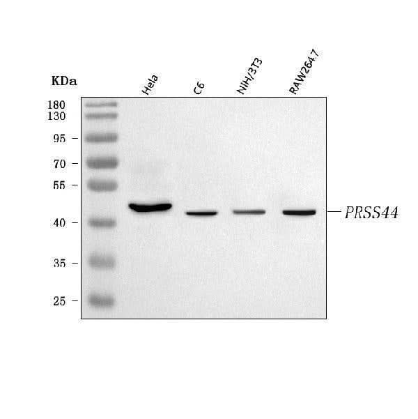 Anti-PRSS44 Antibody Picoband® Boster Bio